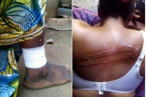 Togo, 2è Jour des manifs : Les brimades de la soldatesque de Faure à Kpalimé.