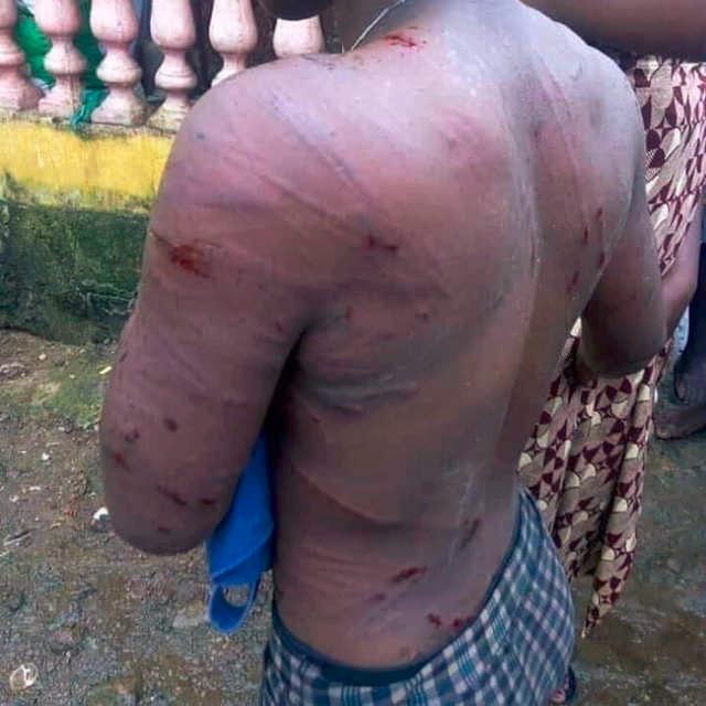 Une jeune fille battue au sang par la sauvage soldatesque de Faure Gnassingbé à Sokodé, 22 novembre 2019 | Photo : Samari Tchadjobo